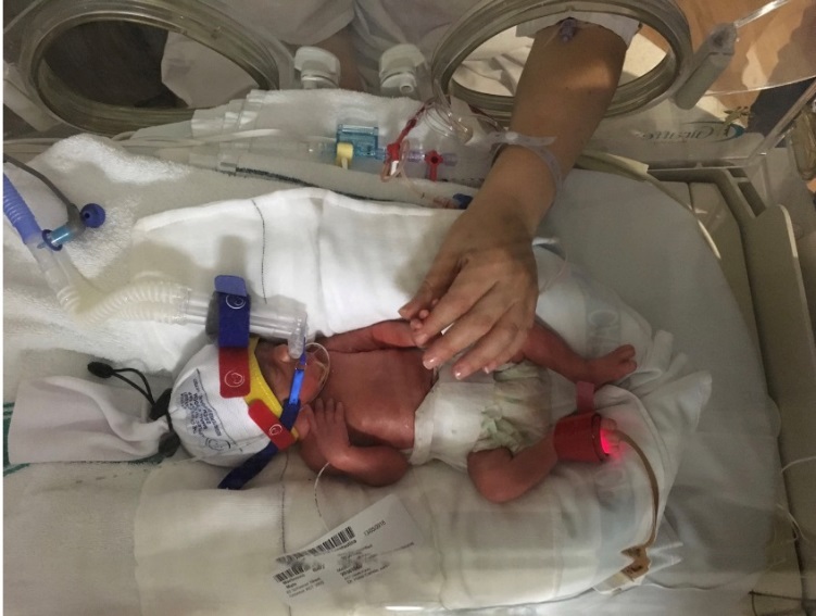 Kristijan in the NICU. He was born three months premature at 27 weeks. Photo: supplied.