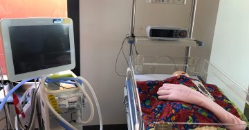 New monitors to help Canberra’s premature babies at Centenary