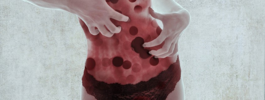 Woman's hands over torso covered in dark red spots - artwork by Margaret Kalms