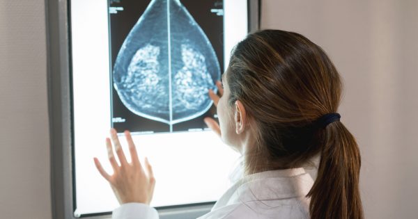 Hormone therapy increases breast cancer risk, years after treatment stops