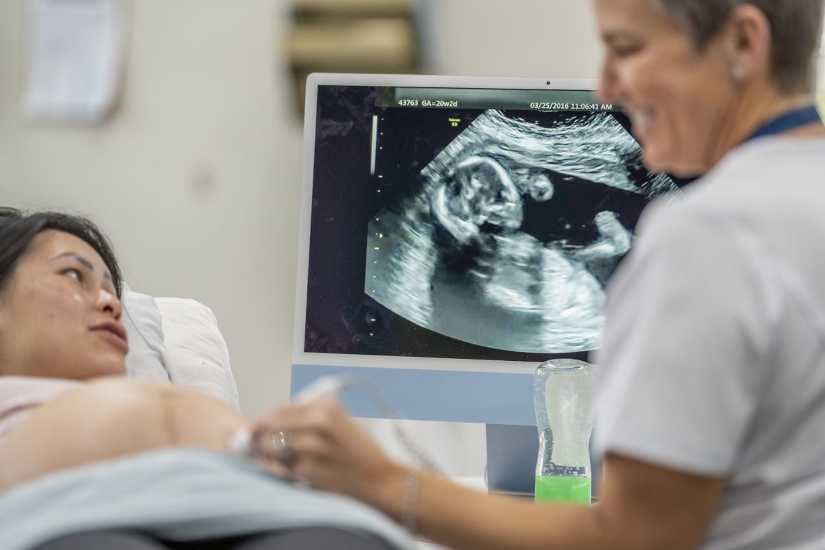 woman receiving an ultrasound