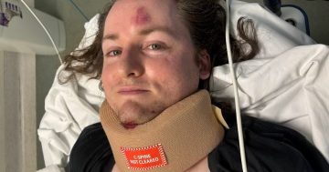Cyclist hit by car at Canberra Avenue intersection days after it's listed as 'unsafe'