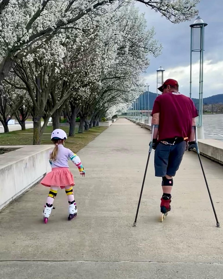 Man with one leg roller blading